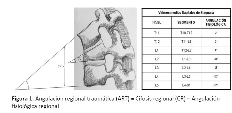 angulación regional traumática