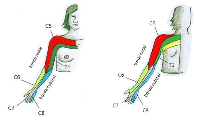 distribución metamérica braquialgia