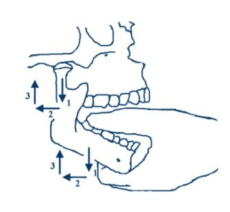 Odontalgia