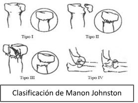 Clasificación Manon