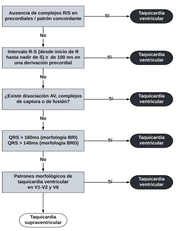 diagnostico taquicardia ventricular