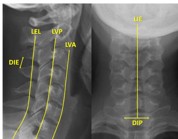 radiología simple rx cervical
