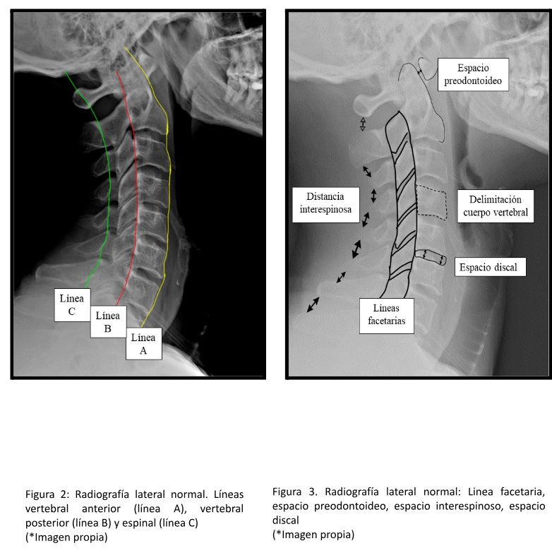 rx cervical datos
